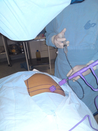 disecto2