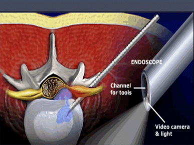endoscopia